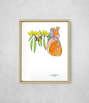 The Heartbreak of '15, framed, front on