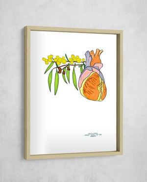 The Heartbreak of '15, Gallery Border style, large format